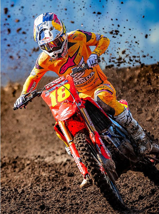 MX